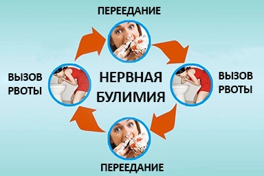 Лечение булимии в Мариинске